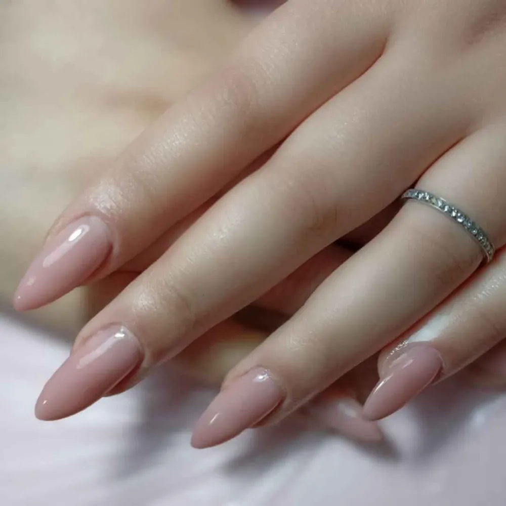 کاشت اولیه با پلی ژل 