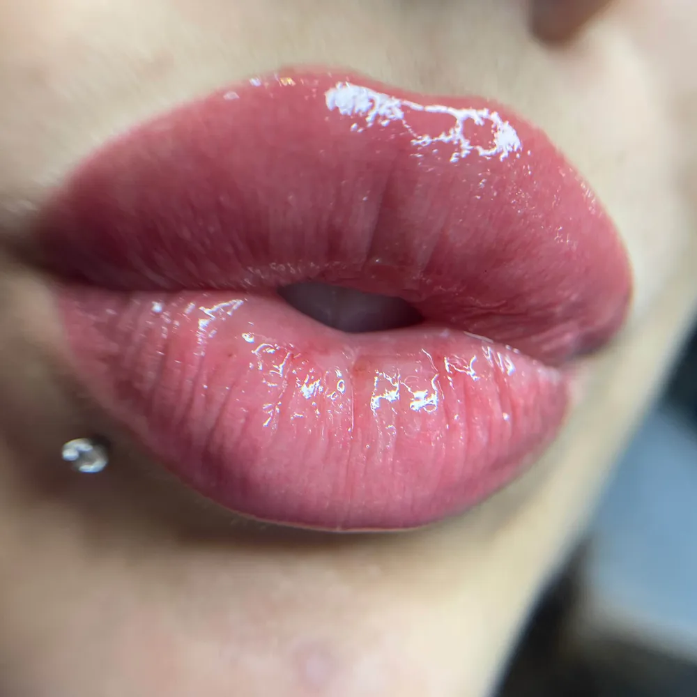 ماندگاری شیدلب بدون ترمیم