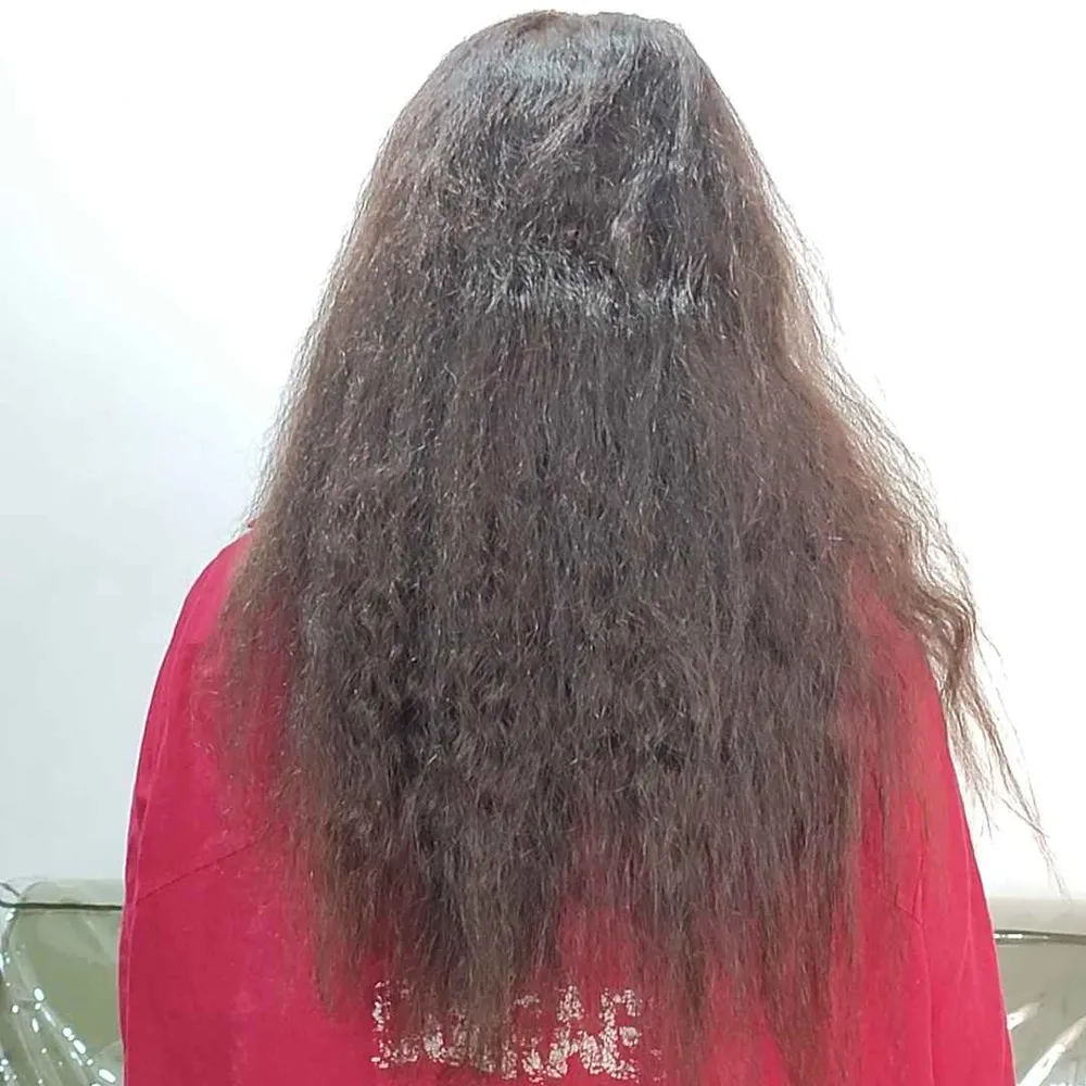 خدمات احیا و صافی و پروتئین تراپی