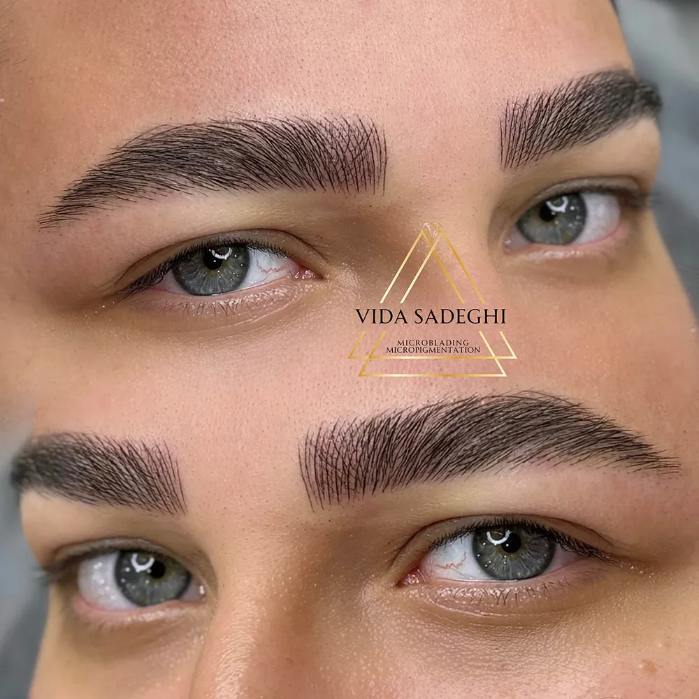 میکروبلیدینگ