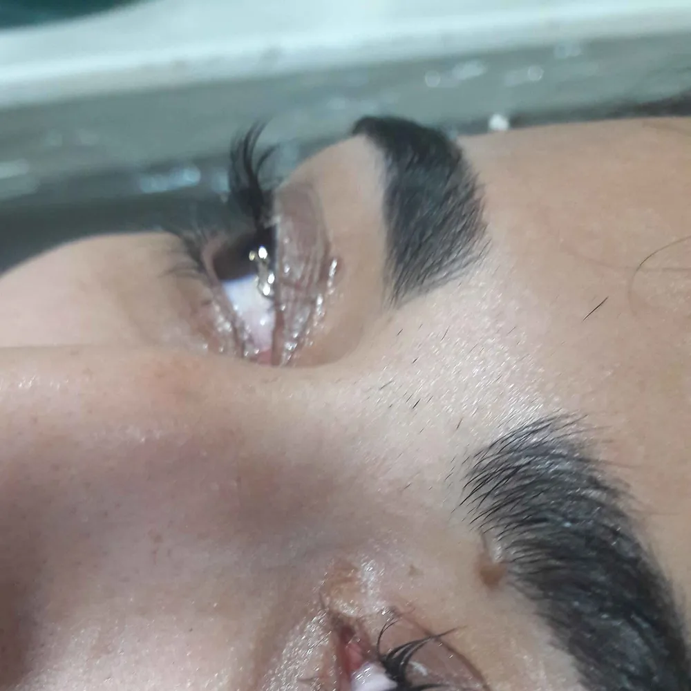 لیفت ابرو و مژه 