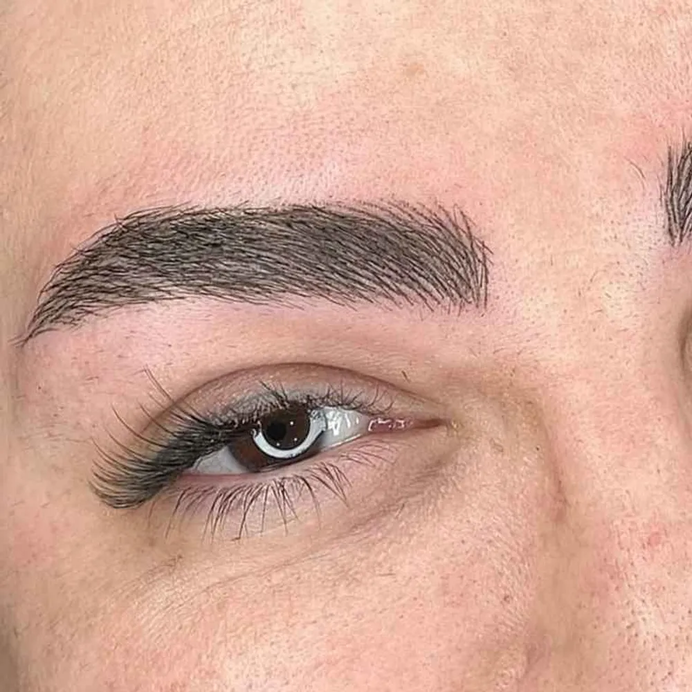 میکرو بلیدینگ