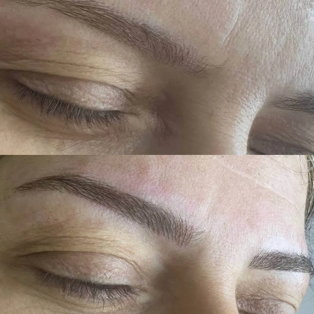 میکروبلیدینگ،فیبروز،نانوبروز،هاشور 