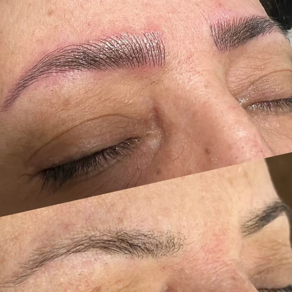 میکروبلیدینگ