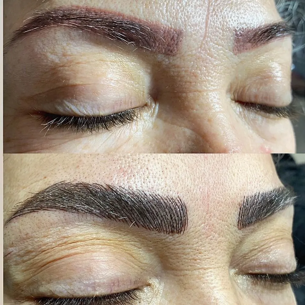 میکروبلیدینگ