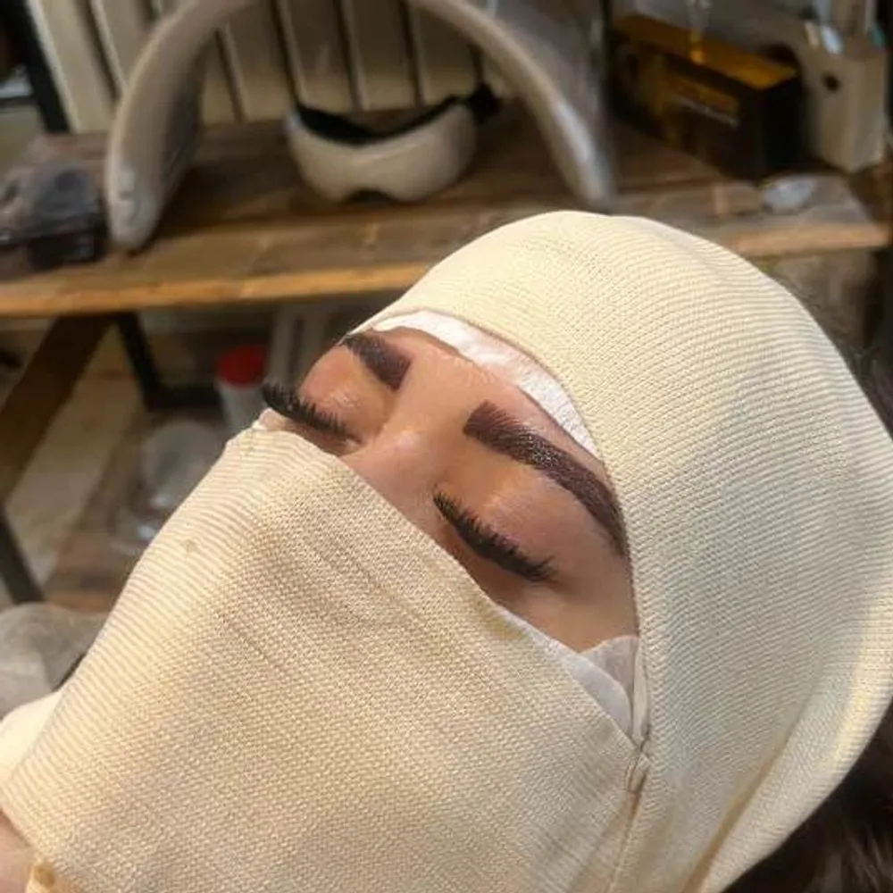 کربوکسی تراپی