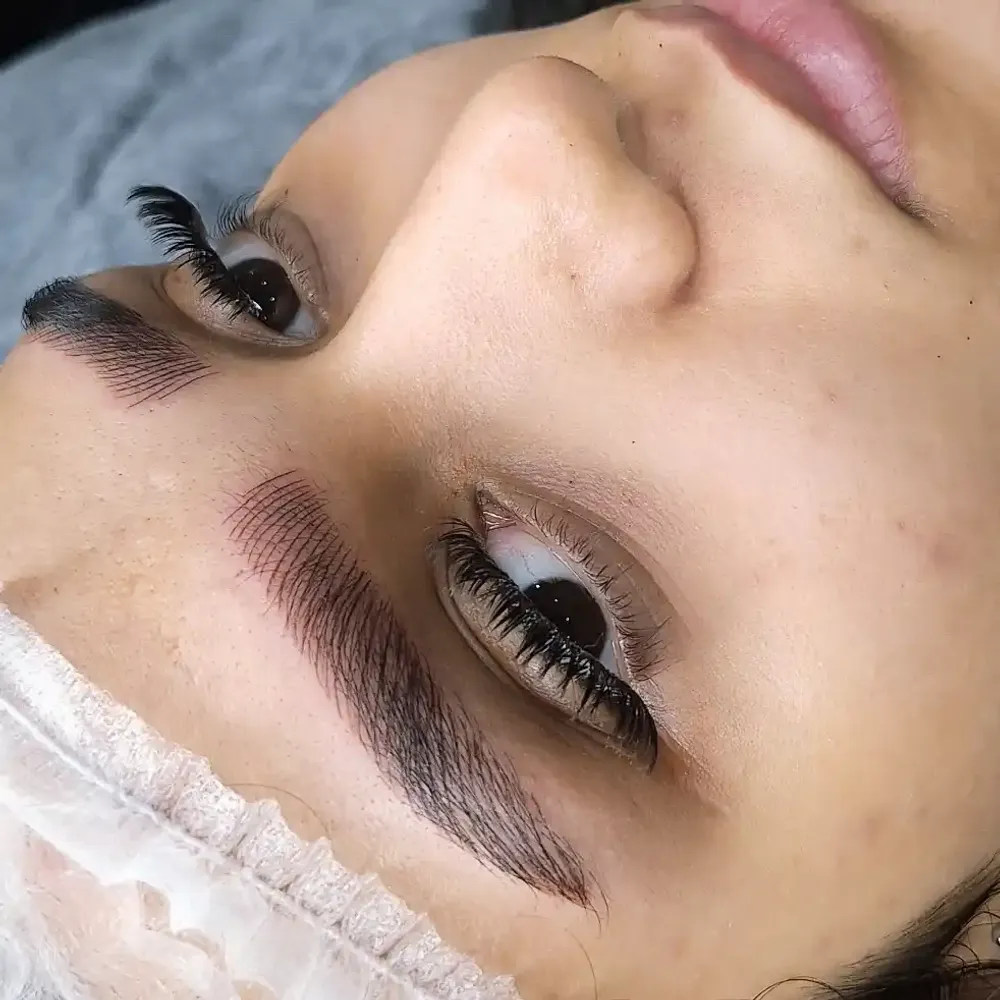 میکروبلیدینگ