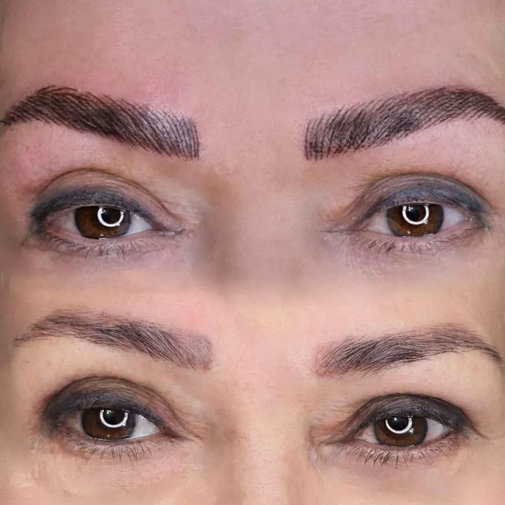 میکروپیگمنتیشن ابرو 