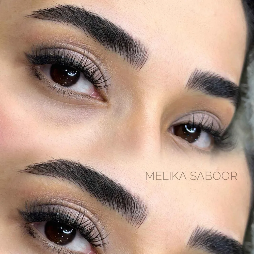 فیبروز ابرو