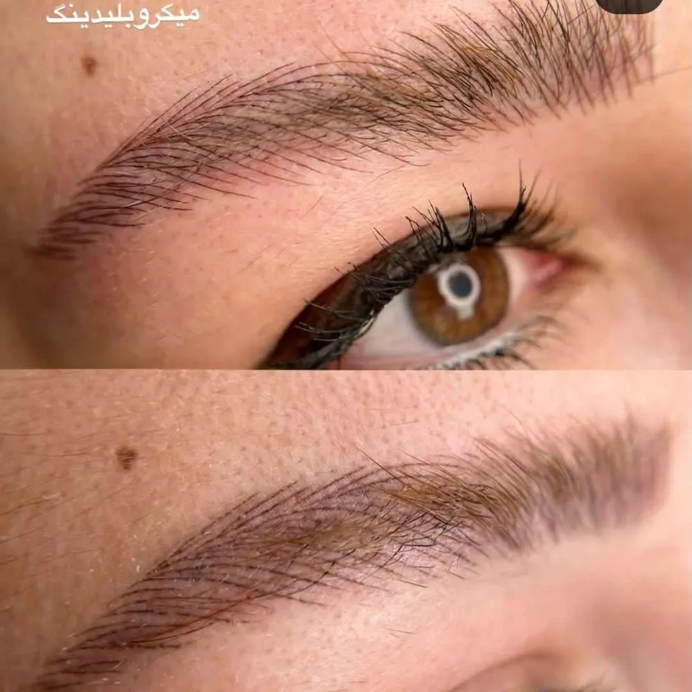 فيبروز ابرو