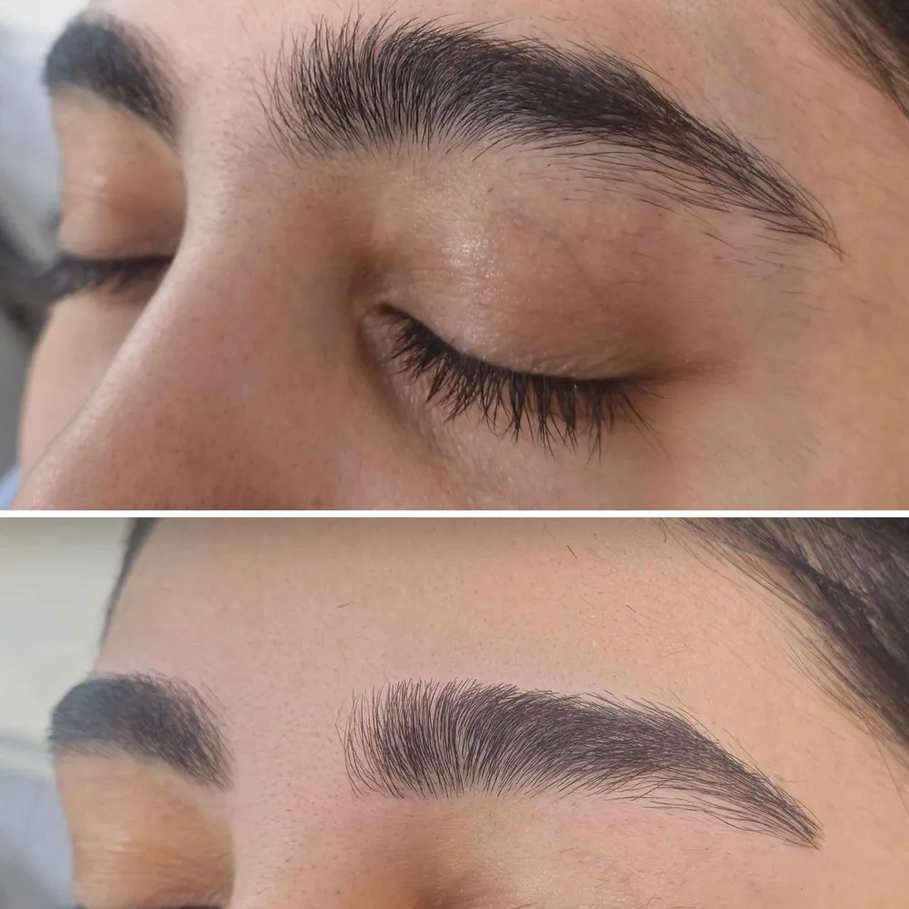 اصلاح فرم ابرو