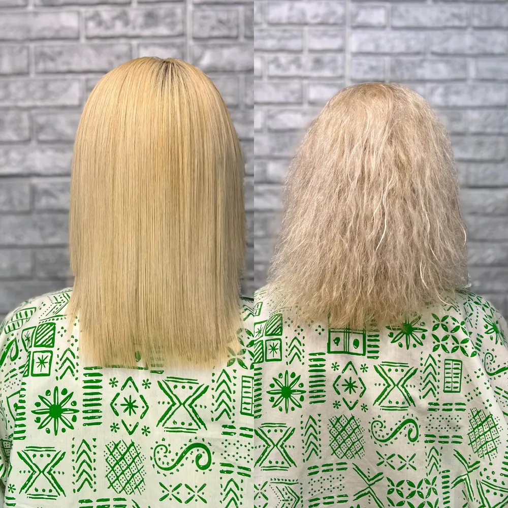 بوتاکس تراپی 