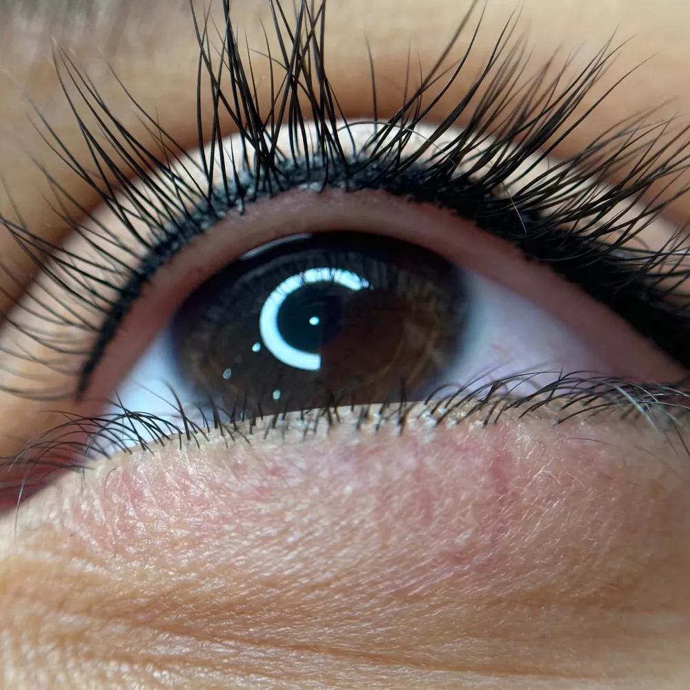 بن مژه قم بدون درد