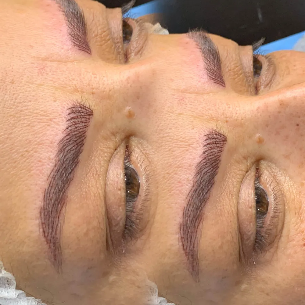 میکروپیگمنتیشن