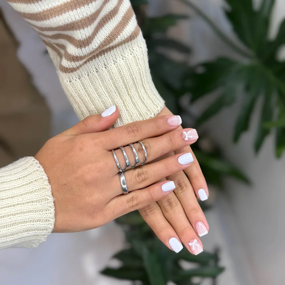 ترميم لمينت