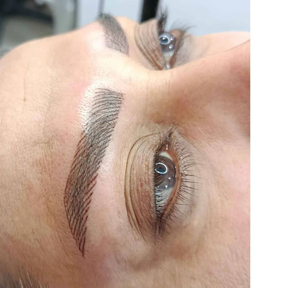 میکروبلیدینگ 