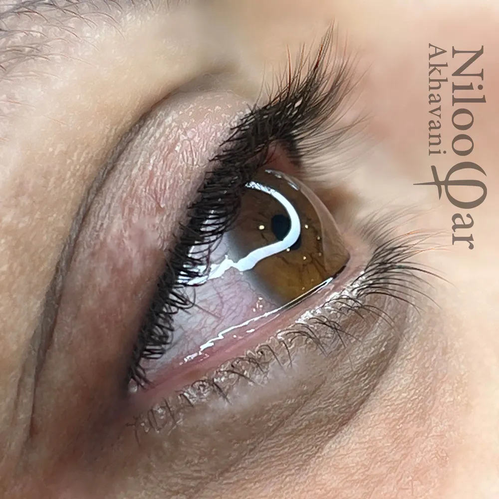 بن مژه نچرال