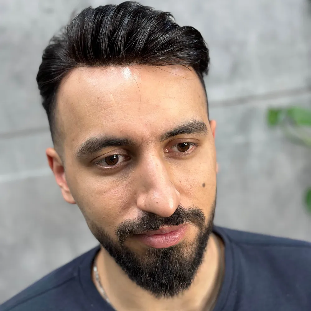 پروتز مو طبیعی