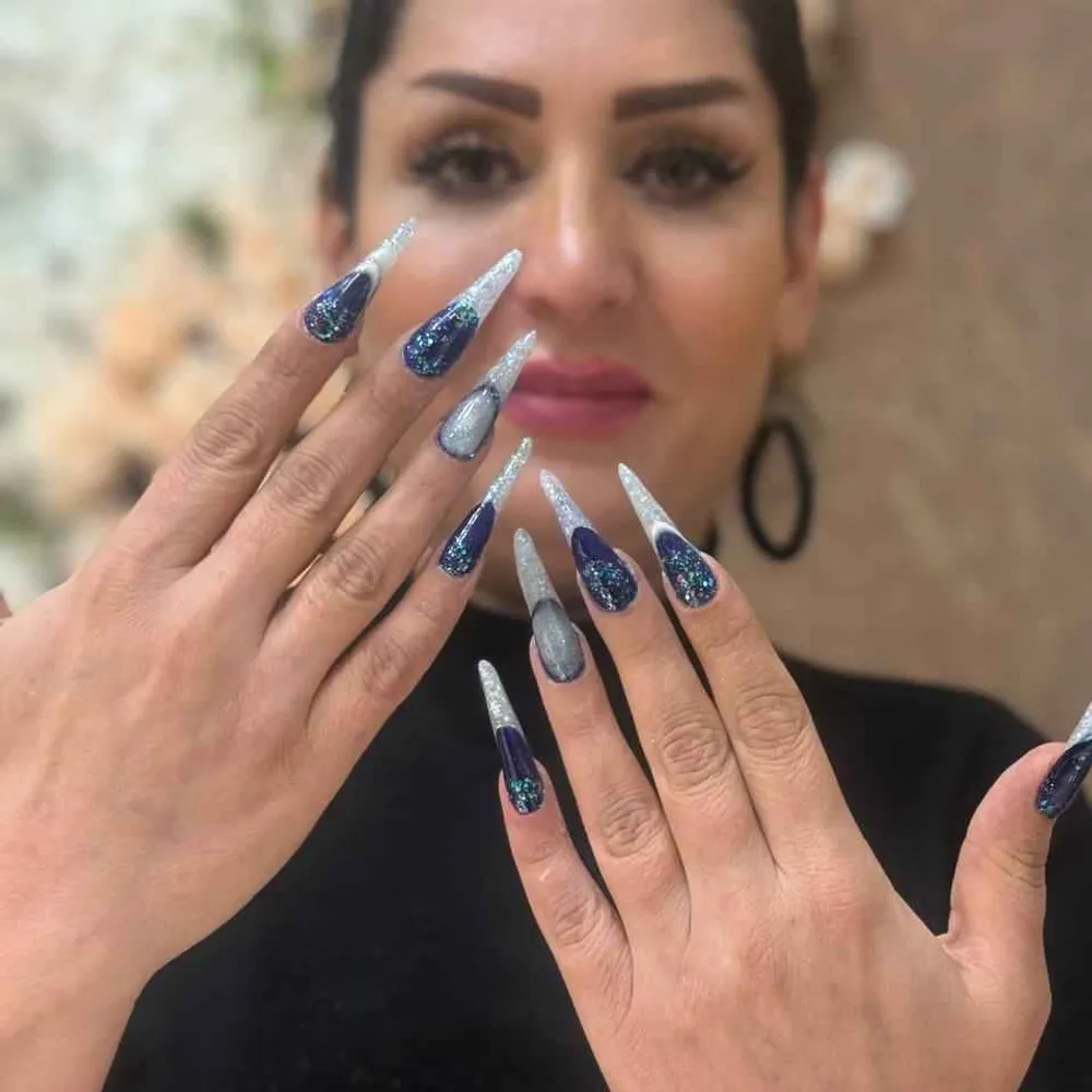 کاشت ژورنالی 