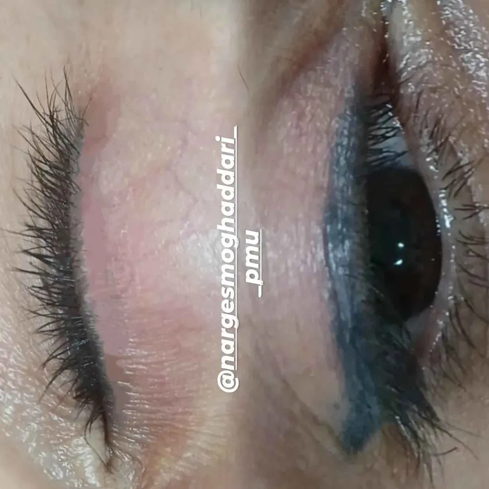 ریموو  خط چشم