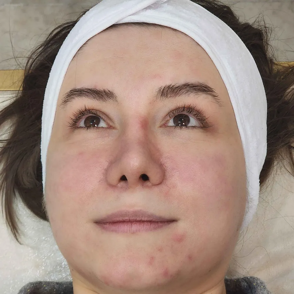 فشیال تخصصی، ریلکسیشن و پاکسازی و سم زدايي