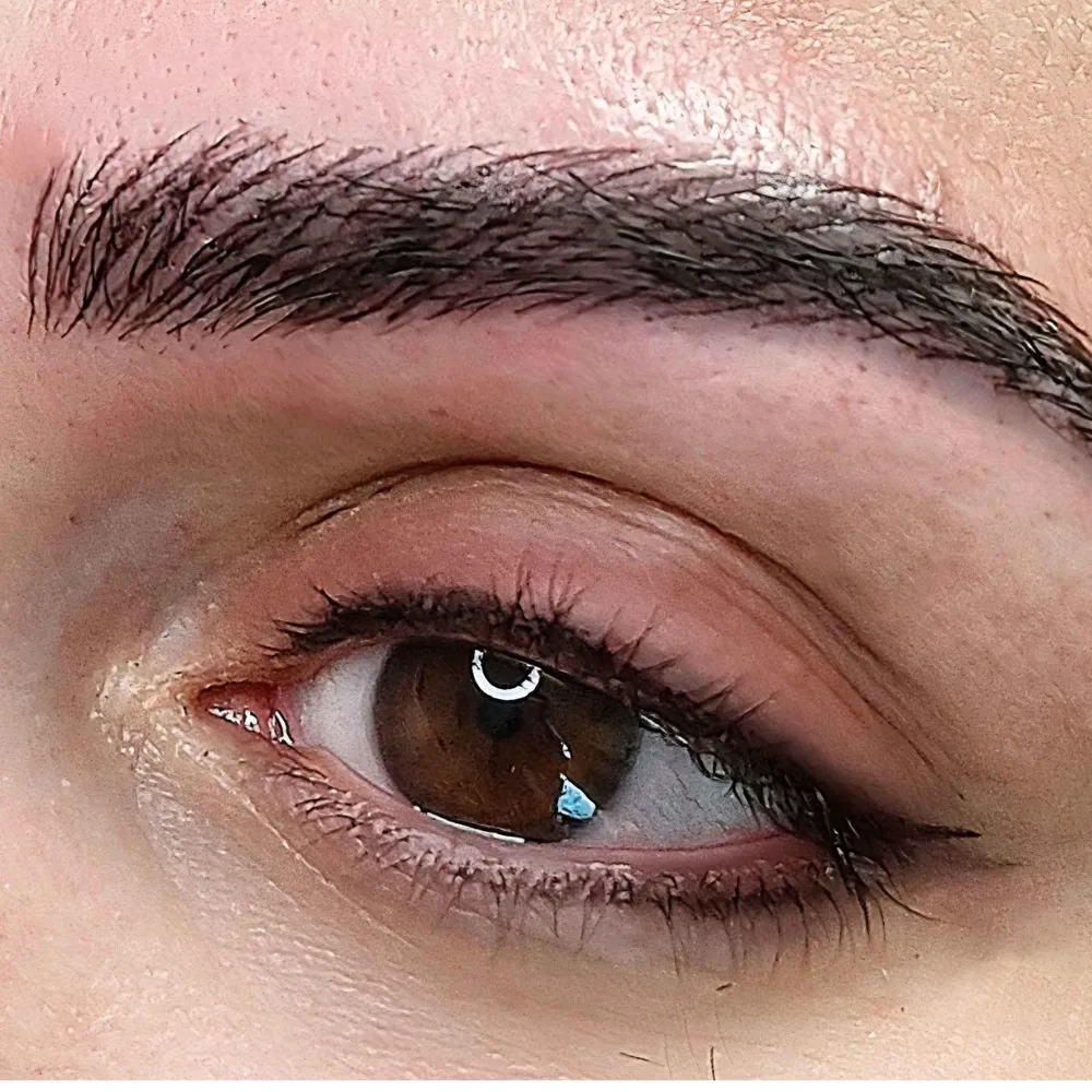 میکرو بلیدینگ