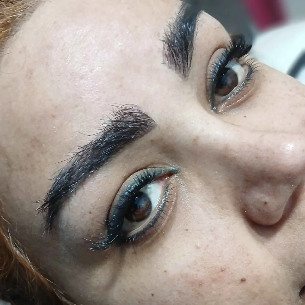 کاشت مژه 