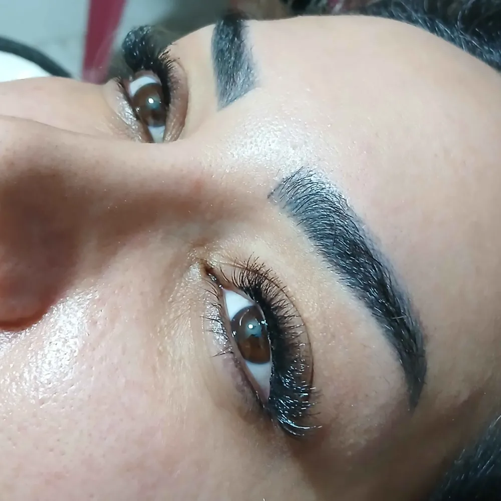 کاشت مژه 
