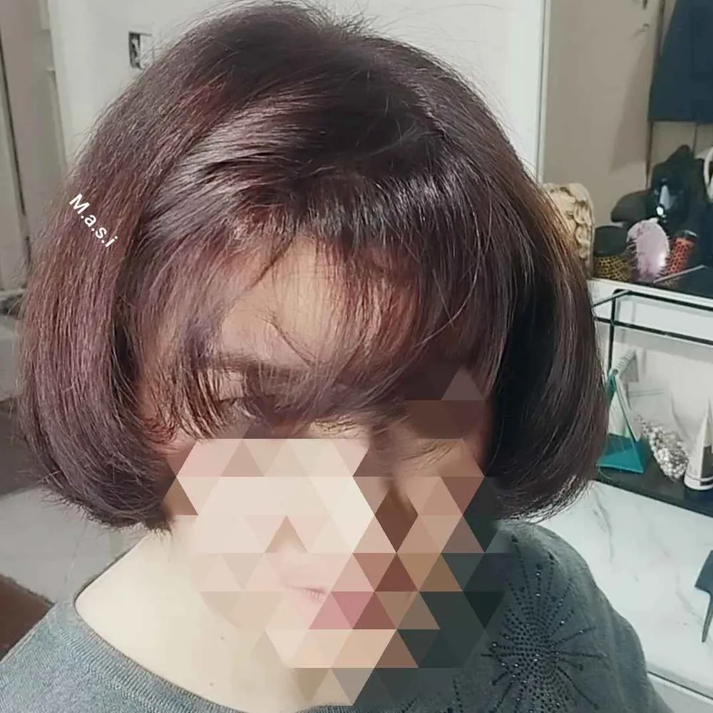 ترمیم ریشه گیری مو 