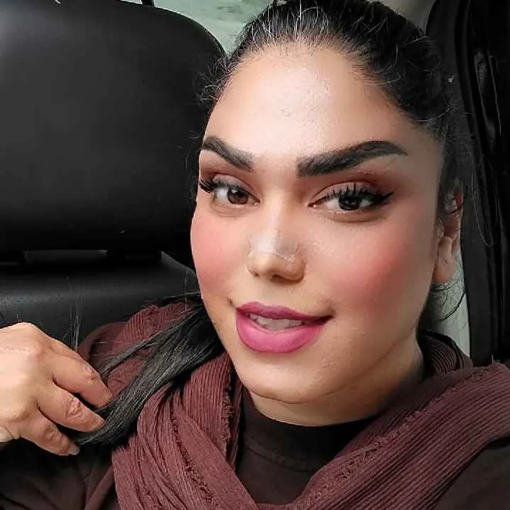 ترمیم مو