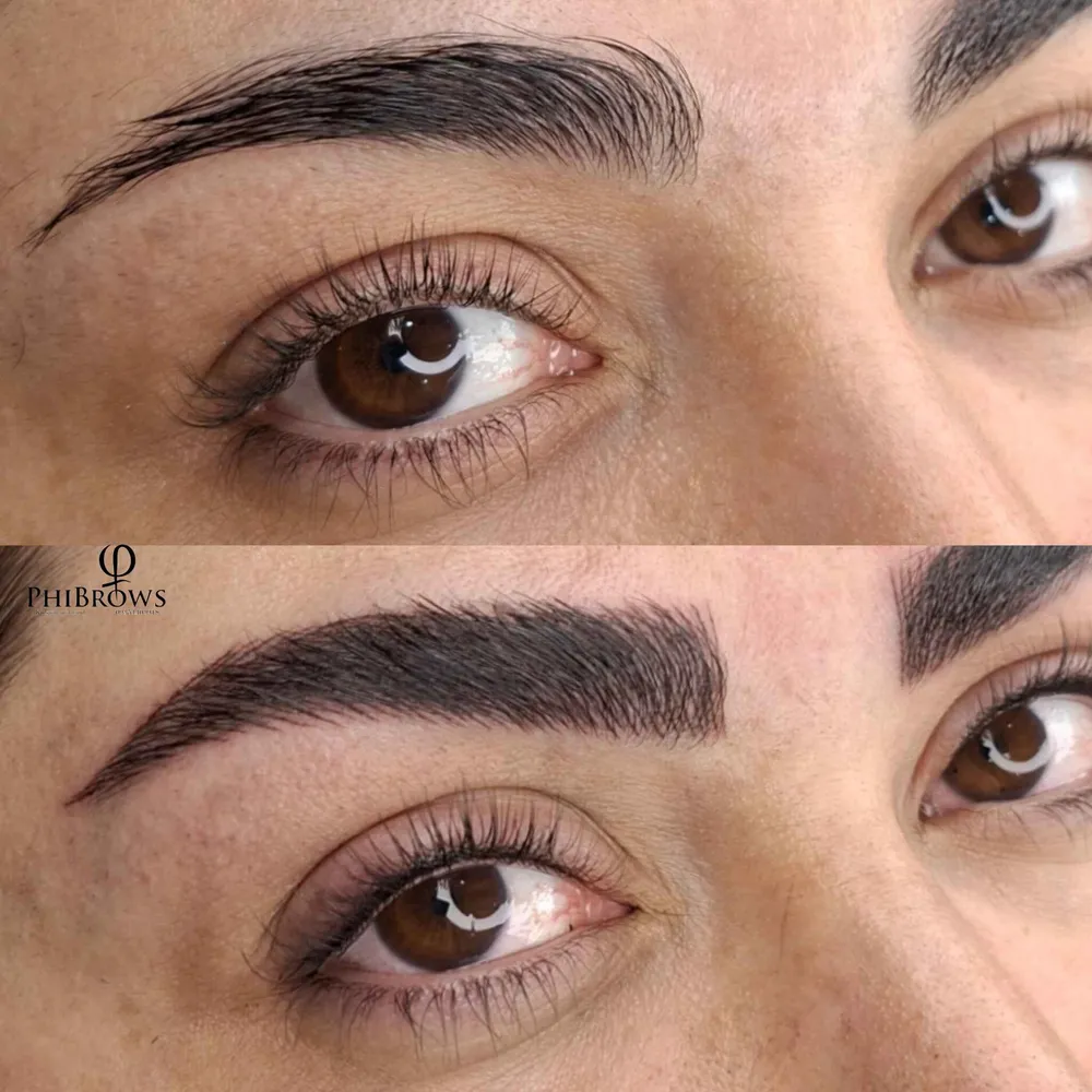 میکروپیگمنتیشن