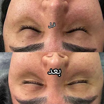 فشیال وپاکسازی 