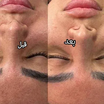 پاکسازی صورت 