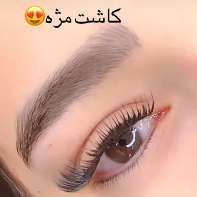 کاشت مژه