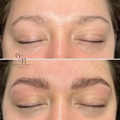 غزاله باستاني 