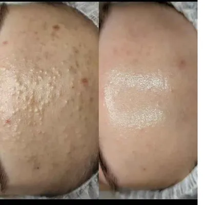 مارال قاسمی 