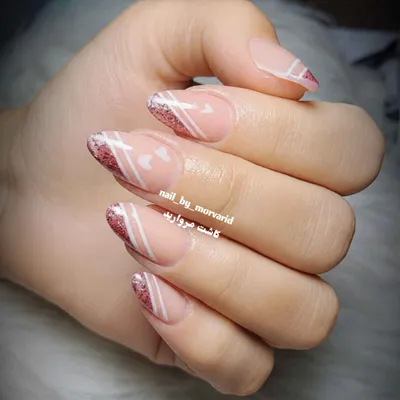 کاشت مروارید 